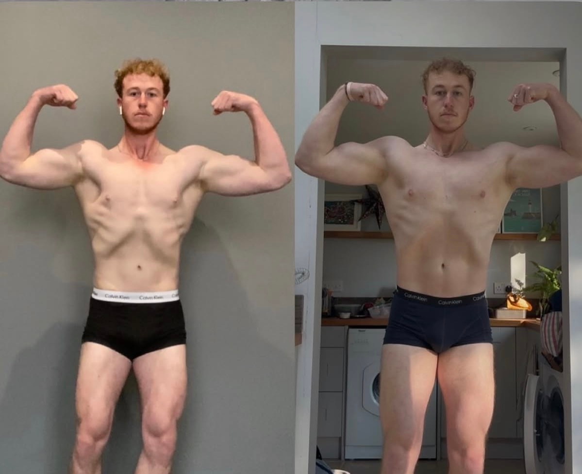 Før-og-etter-bilder av Adrian, 24 år.