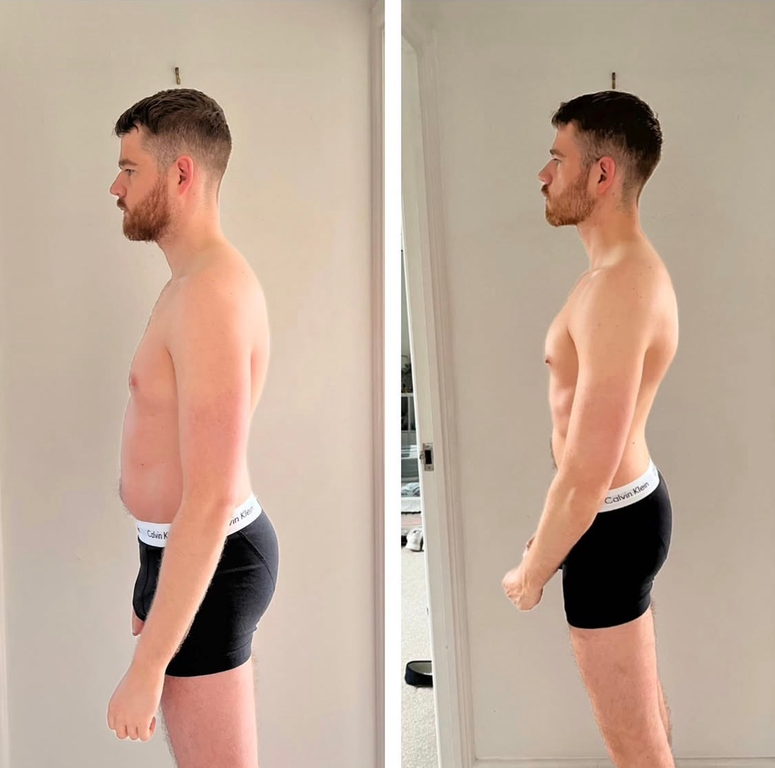 Før-og-etter-bilder av Nikola, 24 år.